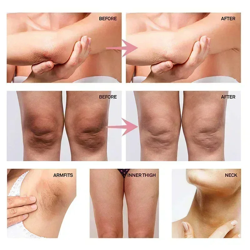 Collageen crème voor het bleke - Skincare Whitening recensie en prijs