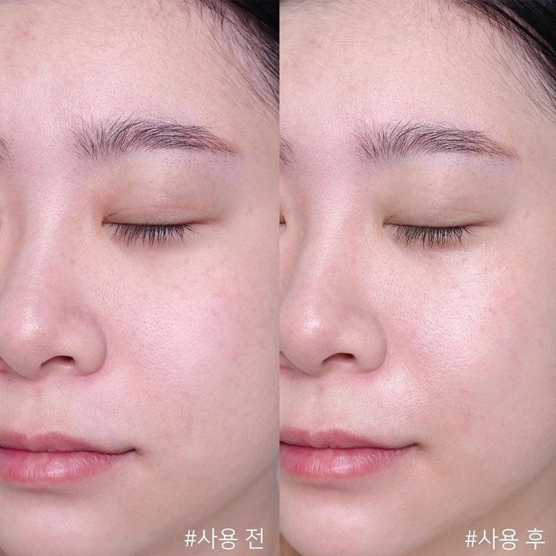 Centella Asiatica Time Reverse - Centella Asiatica Toner recensie en prijs