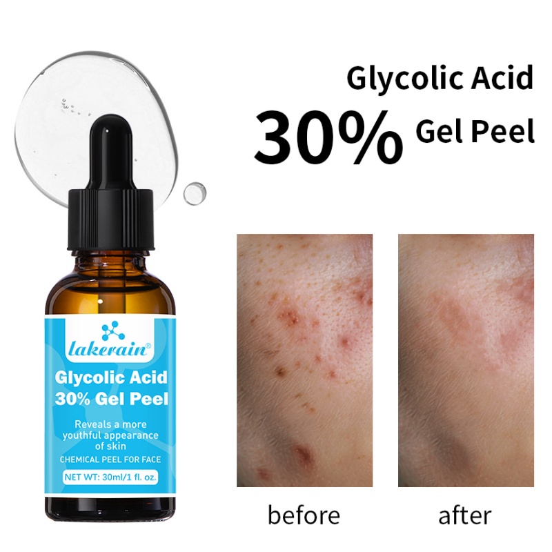 30% Glycolzuur Peel Gel Profes - Lactic Acid Toner recensie en prijs
