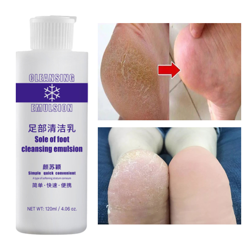 120Ml Voetverzorging Set Voet  - Skincare Exfoliating recensie en prijs