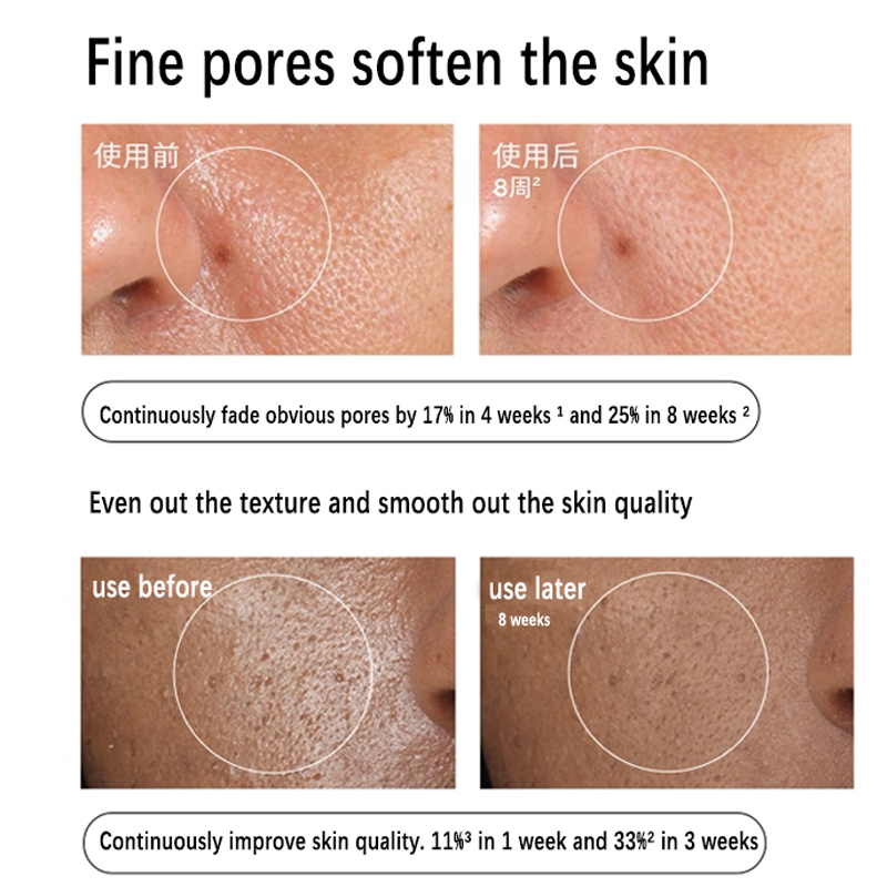 Aloe 2% + NAG 2% Oplossing Ser - Alpha Arbutin Serum recensie en prijs